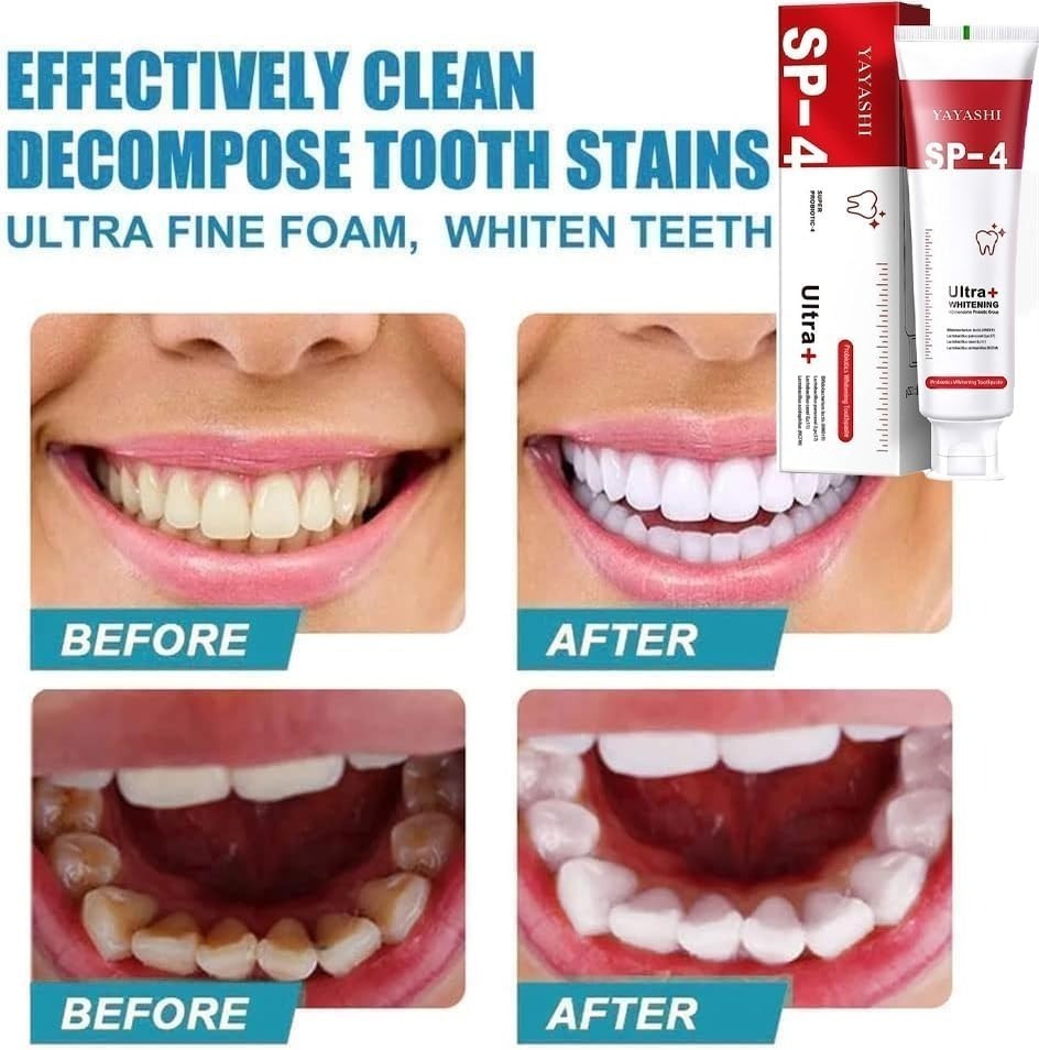 YAYASHI SP-4 Probiotic Toothpaste – Ultra Whitening & Fresh Breath
